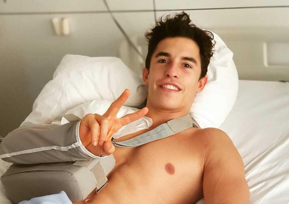 Marc Marquez &ldquo;festeggia&rdquo; un anno dall&rsquo;operazione alla spalla: storia di una maledizione