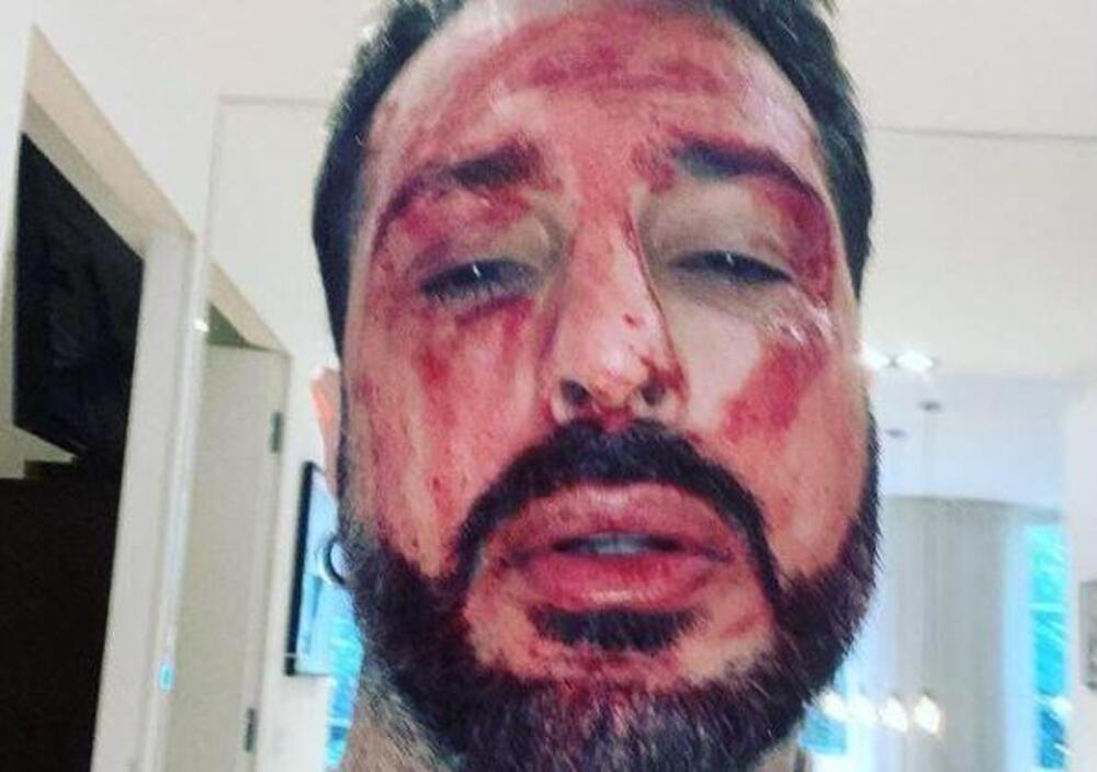 &quot;Deve tornare in carcere&quot;. Alla notizia Fabrizio Corona si ferisce in diretta Instagram. Ecco la sua lettera