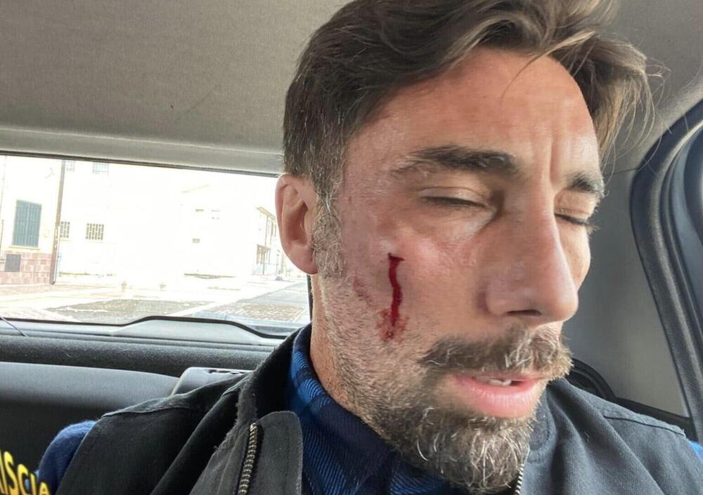 Vittorio Brumotti aggredito a San Severo, ecco l&#039;attimo esatto in cui riceve il pugno [VIDEO]