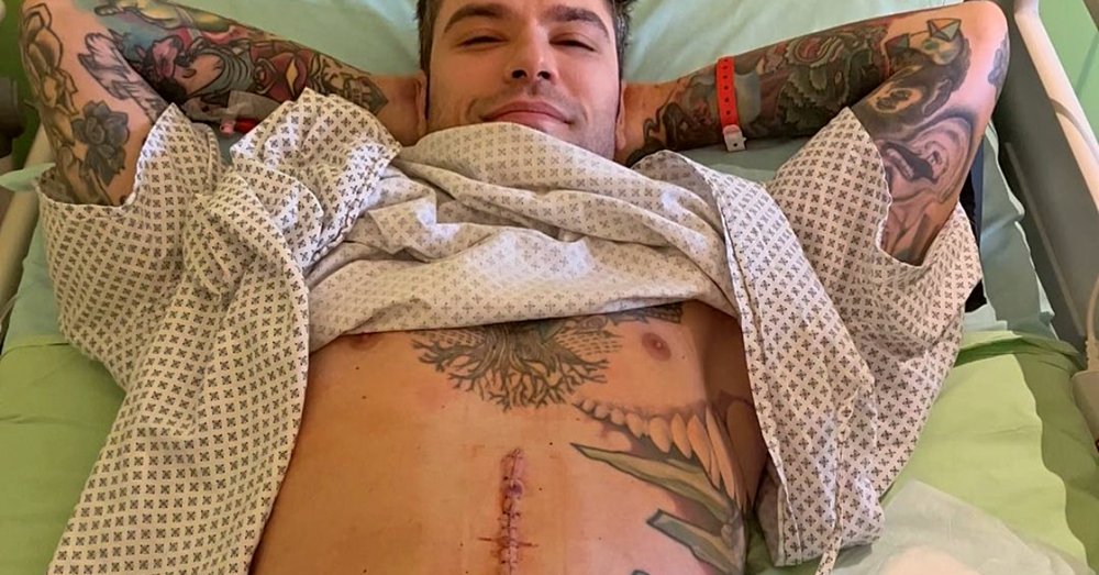 Fedez chiarisce sulla malattia: &ldquo;Ho un tumore al pancreas&rdquo;. E mostra la cicatrice post intervento 