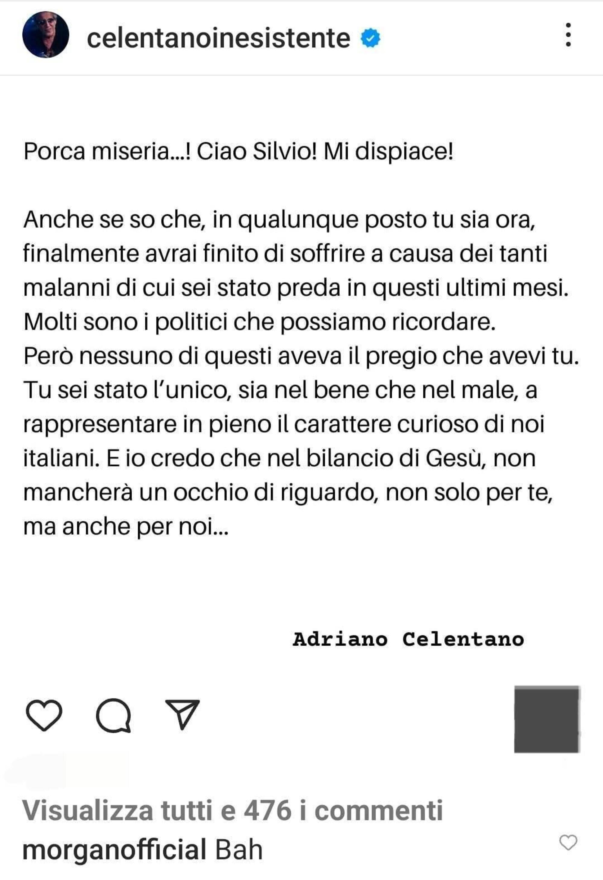 Morgan sotto post Celentano