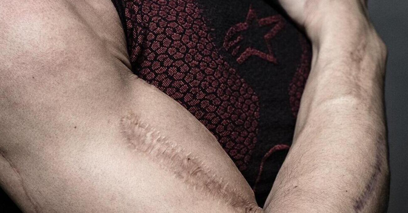 Marc Marquez risponde ai tatuaggi con le cicatrici e ammette: &ldquo;Il mio braccio chiede attenzioni&rdquo;