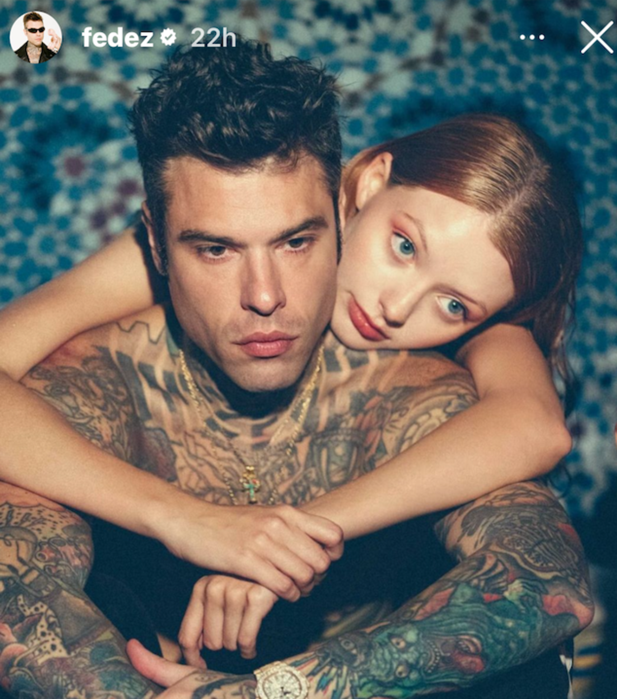 Fedez e la misteriosa ragazza nella sua story Instagram