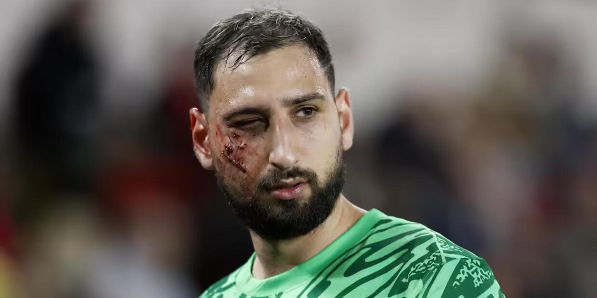 Gigi Donnarumma dopo il calcio di Singo