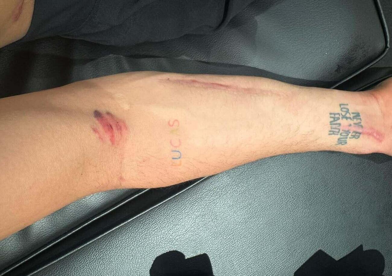 Forse v&rsquo;&egrave; sfuggito, ma Alex Rins in Qatar s&rsquo;&egrave; preso una sassata a 300 Km/h: &ldquo;impressionante&rdquo;. Poi picchia duro sulla crisi Yamaha