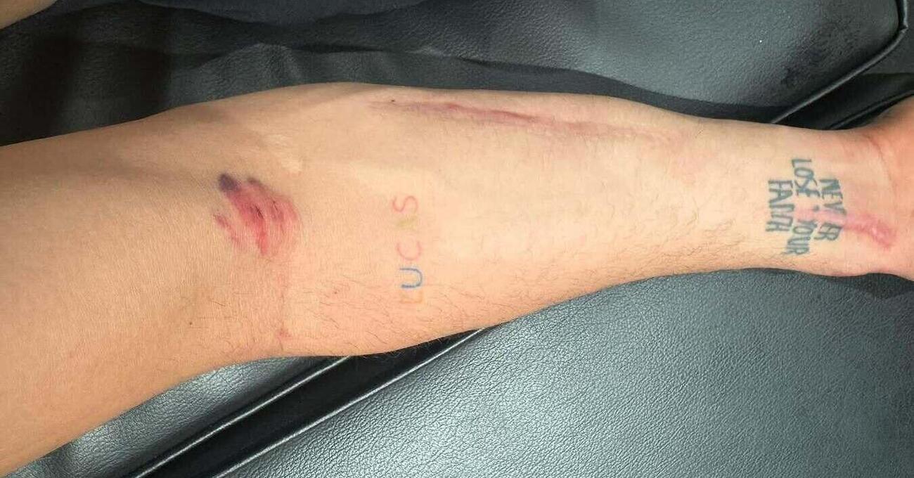 Forse v&rsquo;&egrave; sfuggito, ma Alex Rins in Qatar s&rsquo;&egrave; preso una sassata a 300 Km/h: &ldquo;impressionante&rdquo;. Poi picchia duro sulla crisi Yamaha