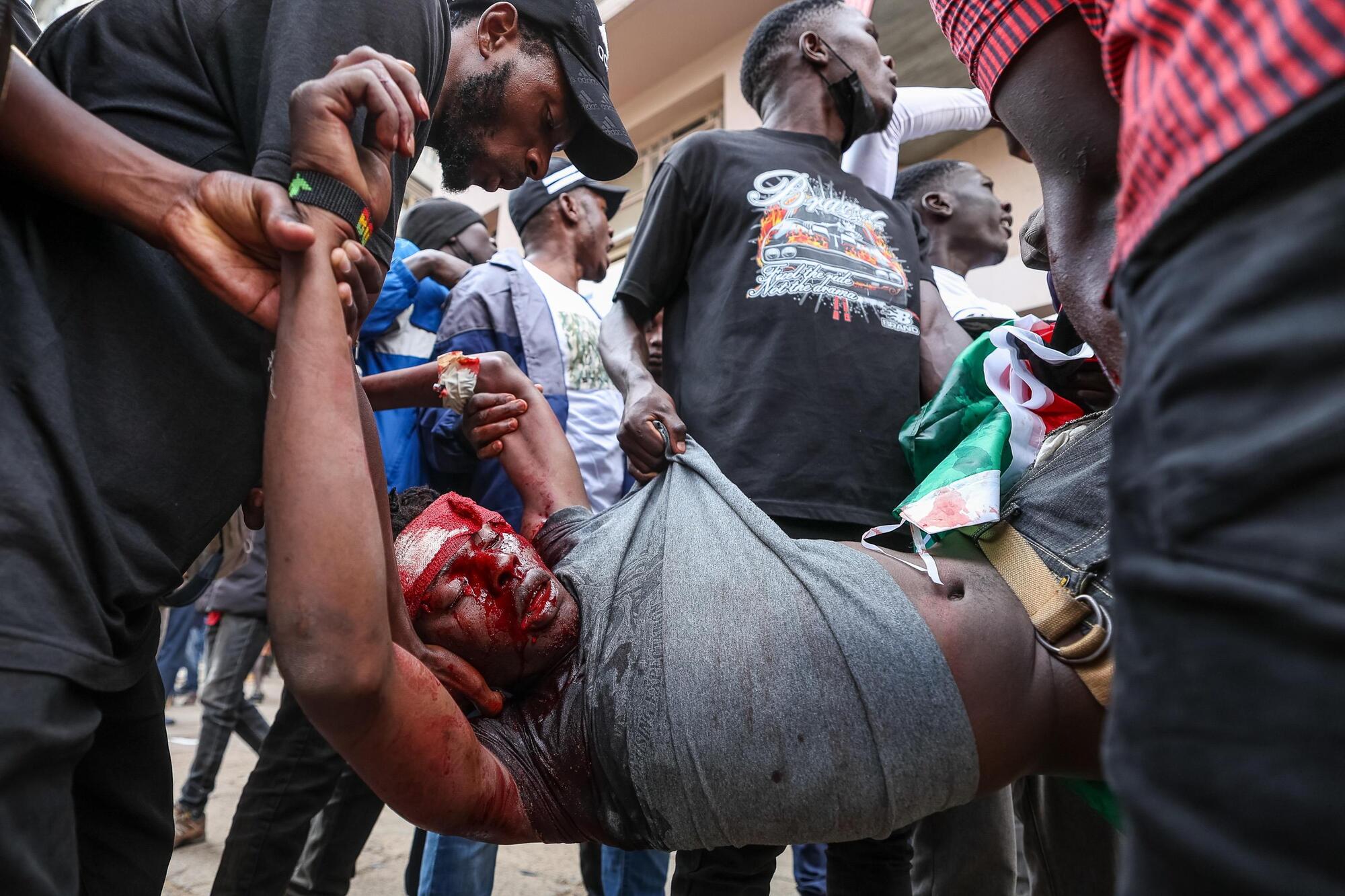 Le proteste della Gen Z in Kenya: un ragazzo a cui la polizia ha sparato viene portato via dagli altri manifestanti