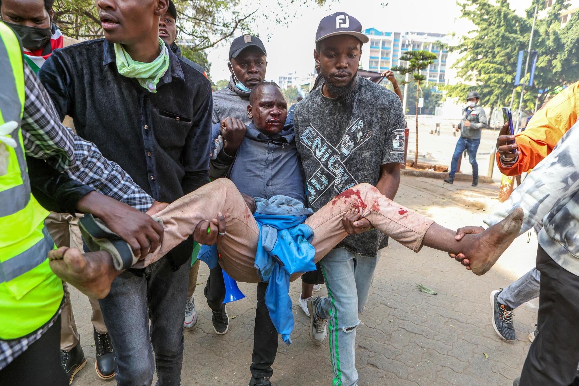 Le proteste in Kenya: un manifestante ferito viene portato via dagli scontri con la polizia