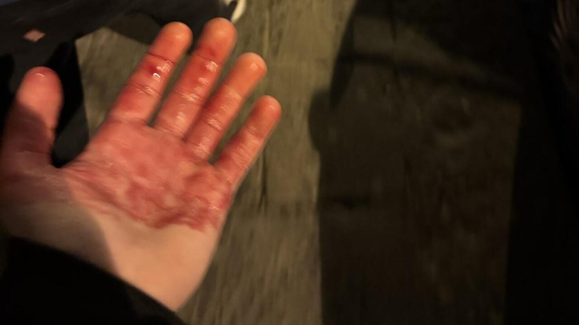 La foto pubblicata dal tifoso del Chelsea aggredito